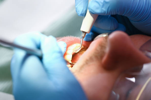 Best Pediatric Emergency Dentist in Cocoa, FL